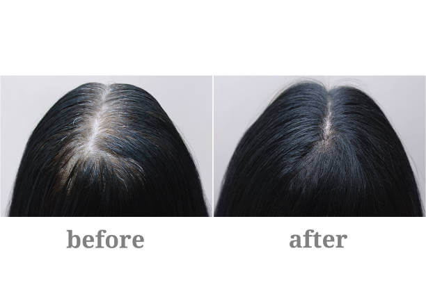 Hollywood Hair Bar Reviews before and after image